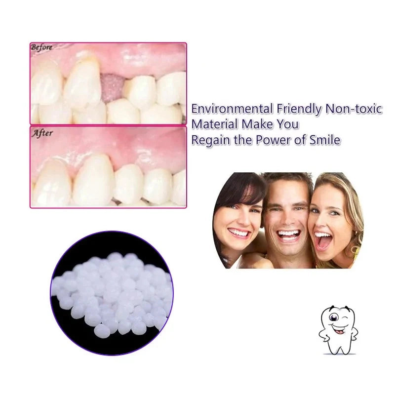 Moldable False Teeth