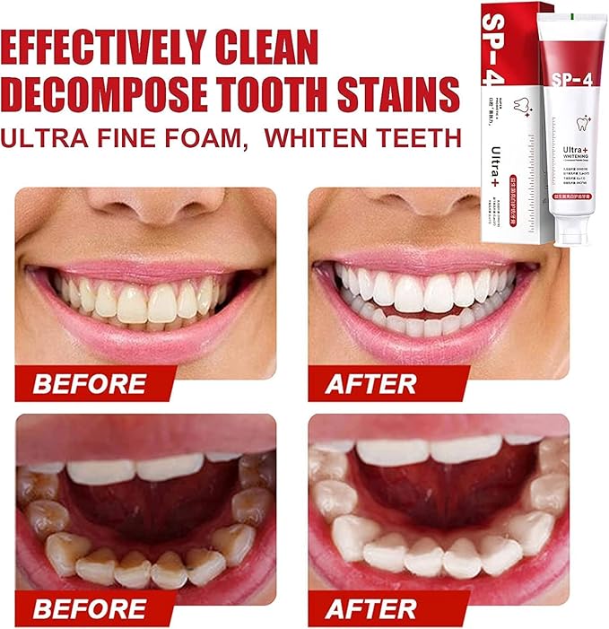 SP-4 Ultra White Probiotic Paste